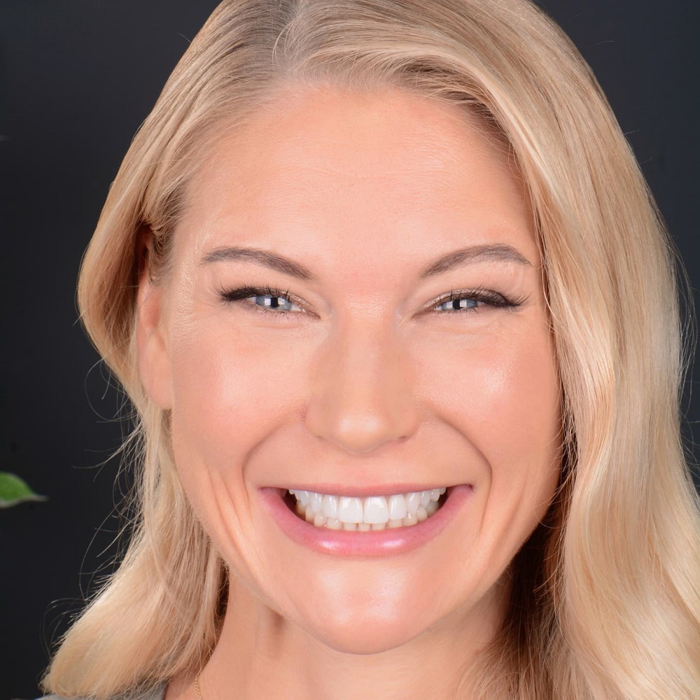 A Woman with Slightly Crooked Teeth